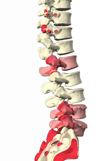 A Healthy Lumbar Curve