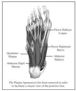 Plantar Fasciitis